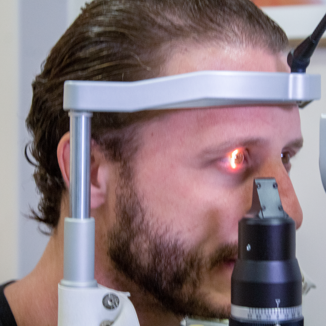 Exames 20 X yag laser (4)